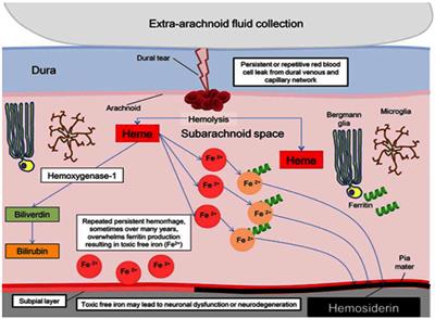 Focused Neuro-Otological Review of Superficial Siderosis of the Central Nervous System